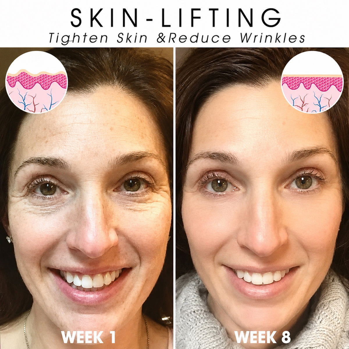 | Last Day Promotion 𝟕𝟎%𝐎𝐅𝐅| - Sparklyra® SkinFirming Rejuvenating Serum