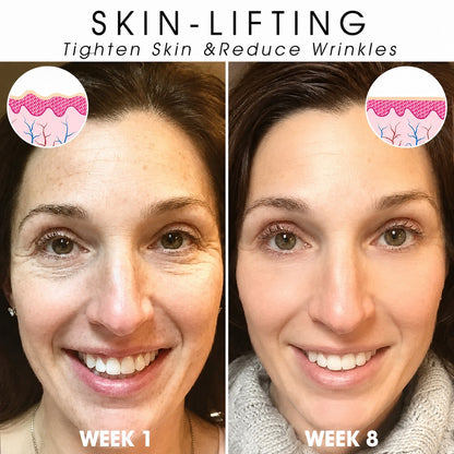 | Last Day Promotion 𝟕𝟎%𝐎𝐅𝐅| - Sparklyra® SkinFirming Rejuvenating Serum