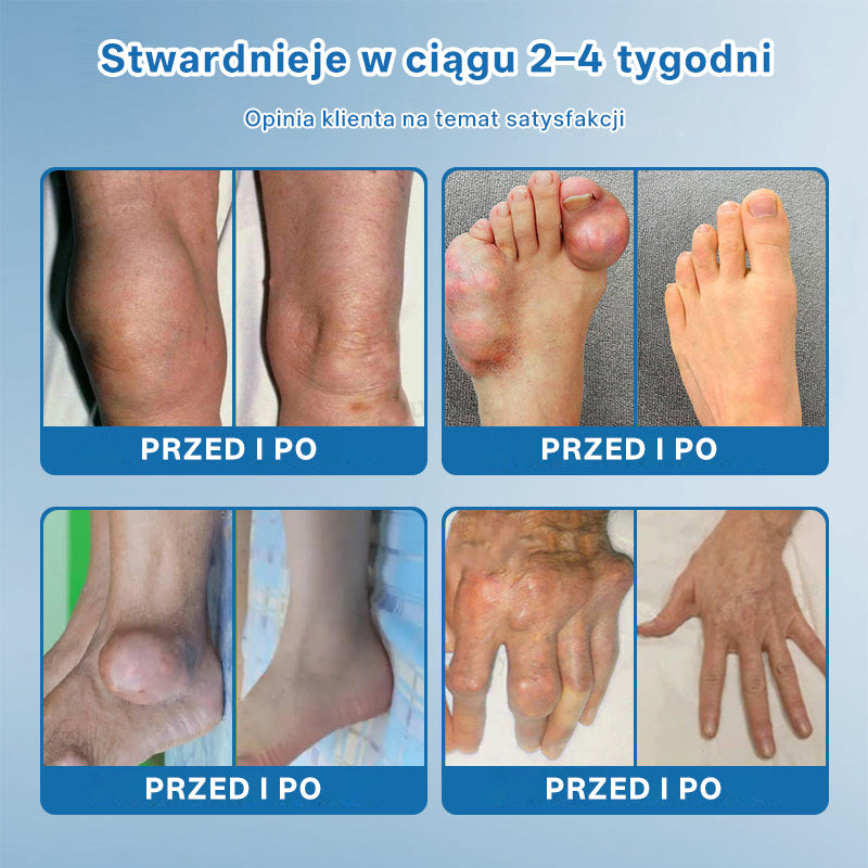 🥇 CleraNaure® BPC-157 Krem do Leczenia Stawów🦴 Leczy Artretyzm, Neuropatię, Reumatyzm, Urazy Sportowe i Więcej✨