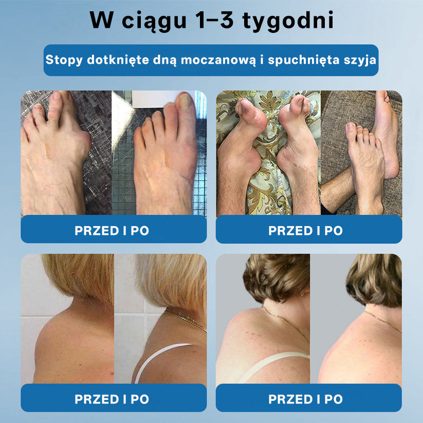 🥇 CleraNaure® BPC-157 Krem do Leczenia Stawów🦴 Leczy Artretyzm, Neuropatię, Reumatyzm, Urazy Sportowe i Więcej✨