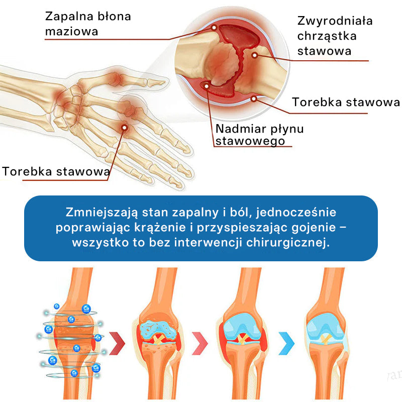 🥇 CleraNaure® BPC-157 Krem do Leczenia Stawów🦴 Leczy Artretyzm, Neuropatię, Reumatyzm, Urazy Sportowe i Więcej✨