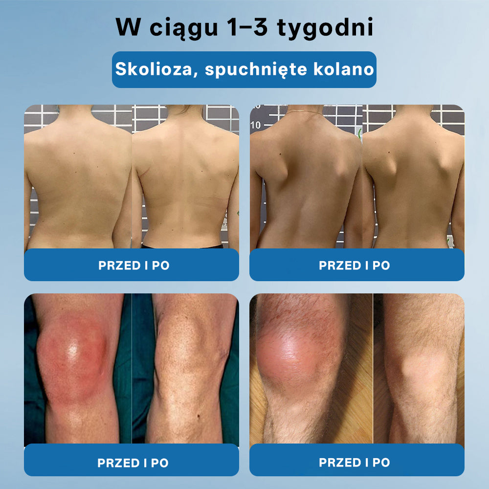 🥇 CleraNaure® BPC-157 Krem do Leczenia Stawów🦴 Leczy Artretyzm, Neuropatię, Reumatyzm, Urazy Sportowe i Więcej✨
