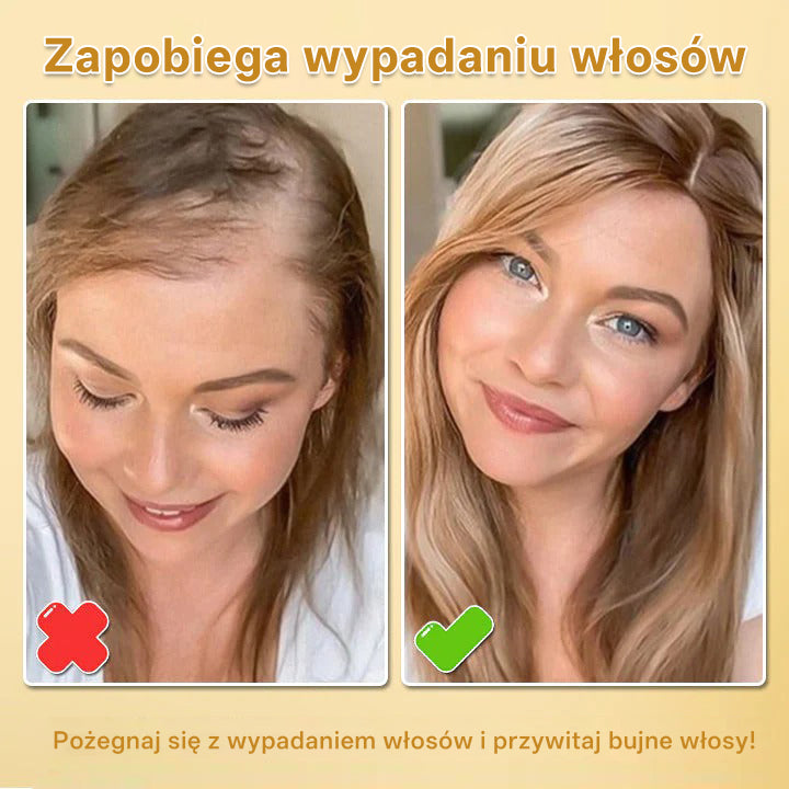 CleraNaure® Biotynowy spray-esencja na porost włosów (Nowa formuła)