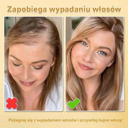 CleraNaure® Biotynowy spray-esencja na porost włosów (Nowa formuła)
