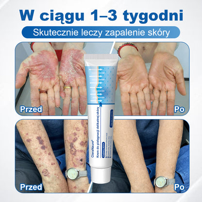 CleraNaure® Krem Naprawczy do Skóry Delikatnej 🌿 Wielotorowa Naprawa – na Siniaki, Suchość i Przebarwienia