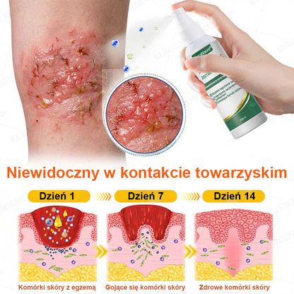 CleraNaure® Eczema Day & Night Repair System – 100% bezwsterydowy duet łagodzący dla intensywnego swędzenia, zaczerwienienia i uszkodzonej skóry (oferta)