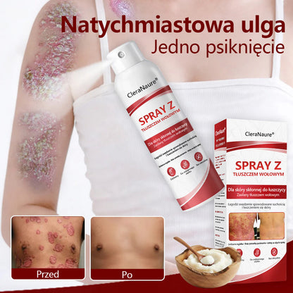 🥇CleraNature® Beef Tallow Spray dla swędzącej, łuszczącej się skóry skłonnej do łuszczycy🥇