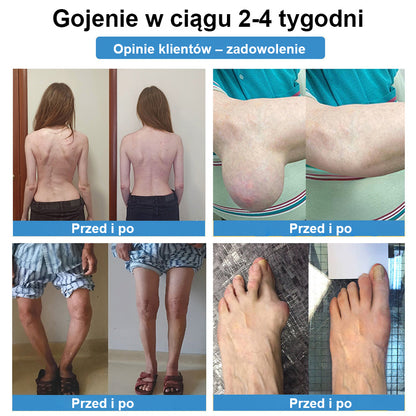 CleraNaure® nanojehličková náplast na klouby