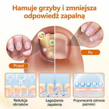 CleraNaure® FungiBee Zaawansowany Spray Naprawczy do Paznokci