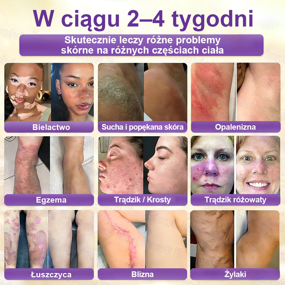 🥇CleraNaure® Krem do Skóry Biotyna 10-w-1 – Odbudowa i Regeneracja