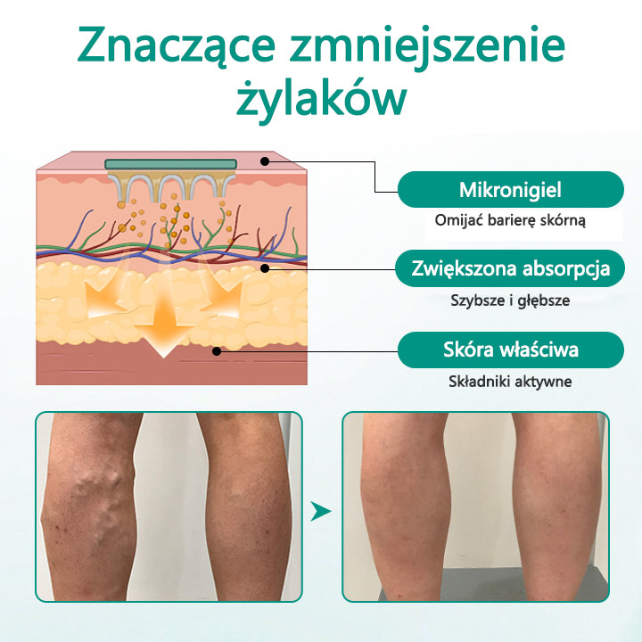 CleraNaure® LegRenew Plaster na żylaki