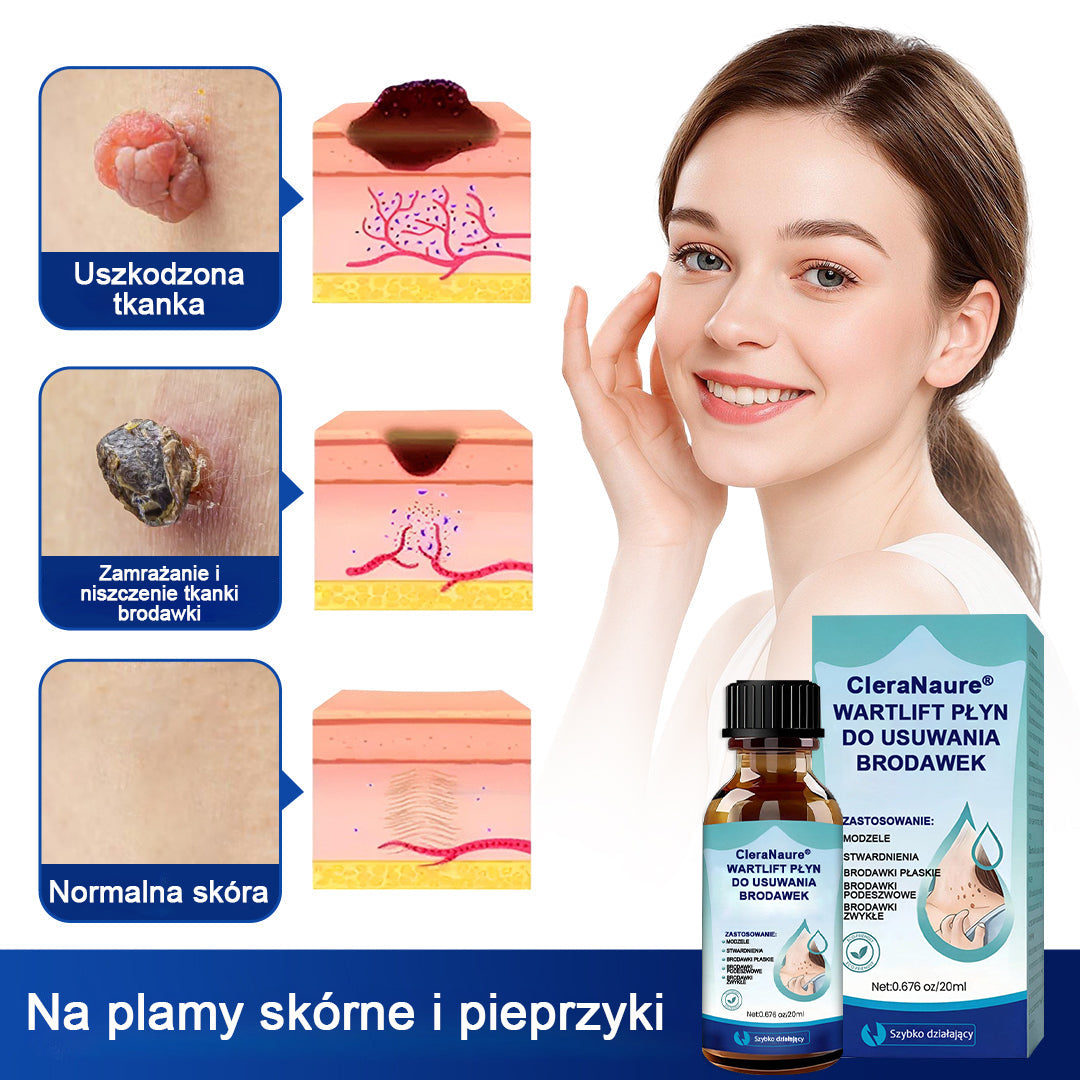 CleraNaure® WartLift Płyn do usuwania odcisków