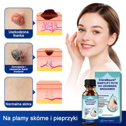 CleraNaure® WartLift Płyn do usuwania odcisków