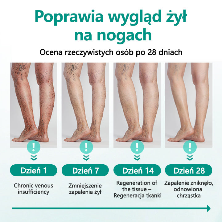 CleraNaure® LegRenew Plaster na żylaki