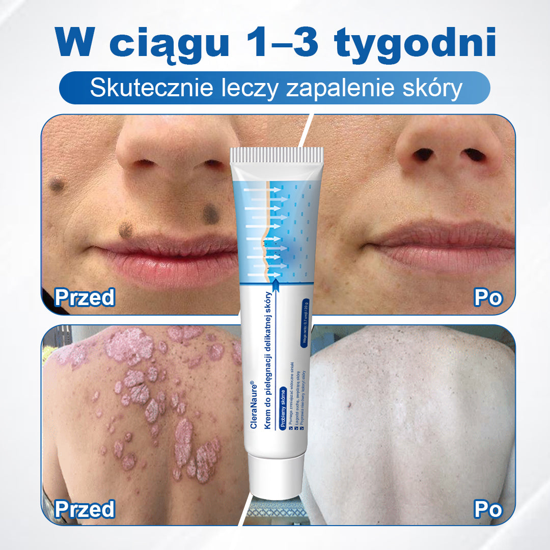 CleraNaure® Krem Naprawczy do Skóry Delikatnej 🌿 Wielotorowa Naprawa – na Siniaki, Suchość i Przebarwienia