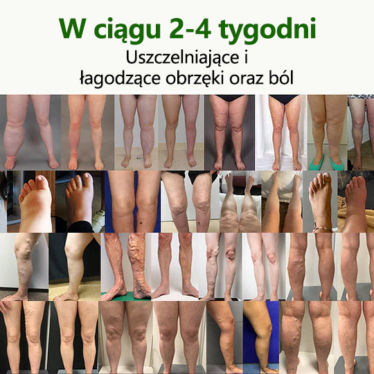 Pożegnaj się z opuchniętymi, bolącymi nogami – CleraNaure® FluidEase Profesjonalny krem na krążenie w nogach przynosi prawdziwą ulgę! ✨🦵