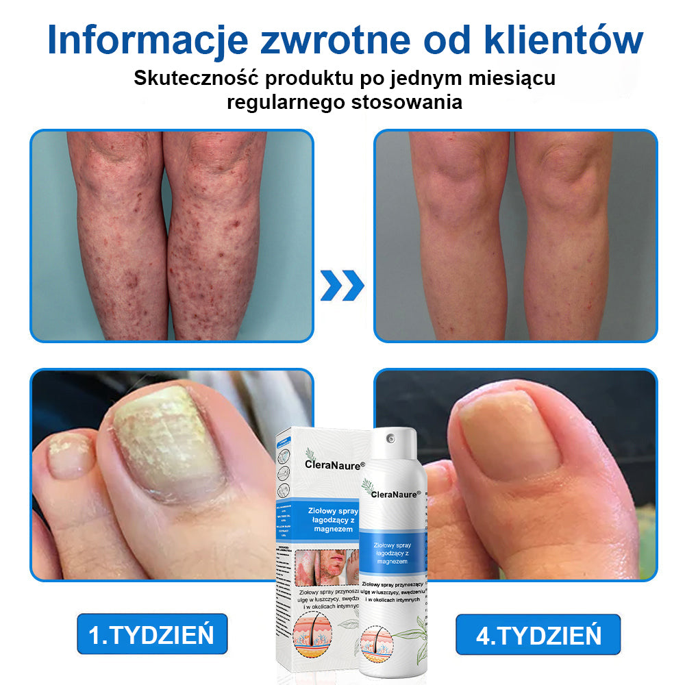 CleraNature® Magnesium Spray – Szybka Ulga dla Swędzącej, Czerwonej i Wrażliwej Skóry (Nawet w Strefach Intymnych)