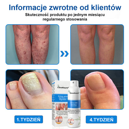 CleraNature® Magnesium Spray – Szybka Ulga dla Swędzącej, Czerwonej i Wrażliwej Skóry (Nawet w Strefach Intymnych)