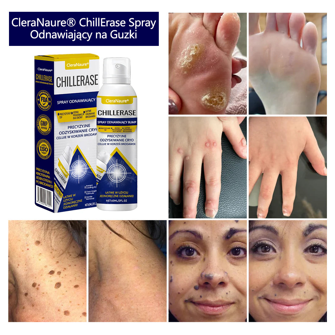 CleraNaure® ChillErase spray do usuwania nierówności
