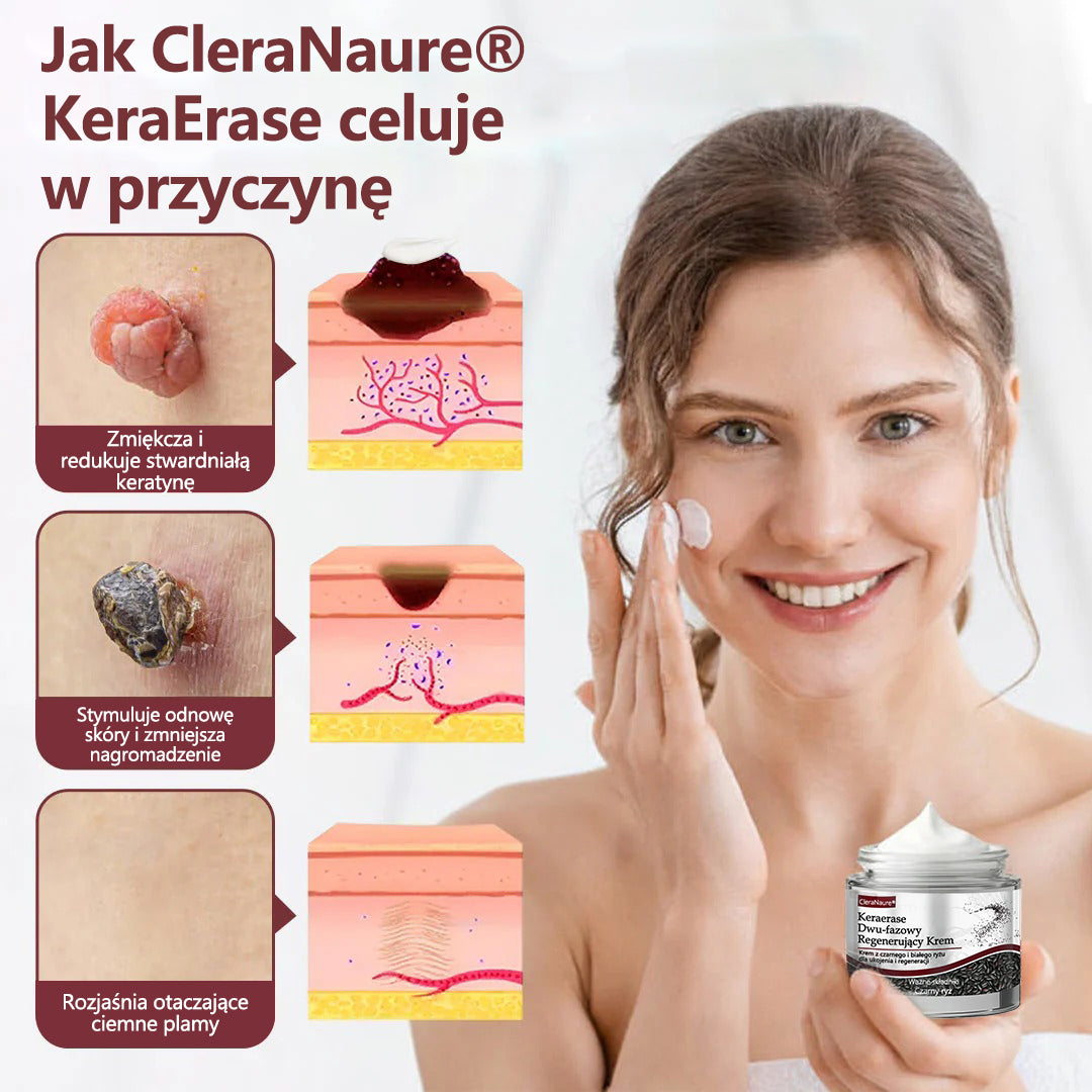 ⭐🏅 Oficjalny sklep CleraNaure® Keraerase Krem Odnowy o Podwójnym Działaniu - Krem z podwójnym działaniem do regeneracji skóry (wygładza wypukłe grudki i rozkłada głębokie nagromadzenie keratyny bez kwasów i podrażnień)