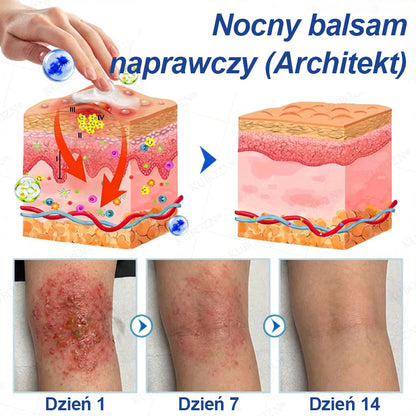CleraNaure® Eczema Day & Night Repair System – 100% bezwsterydowy duet łagodzący dla intensywnego swędzenia, zaczerwienienia i uszkodzonej skóry (oferta)