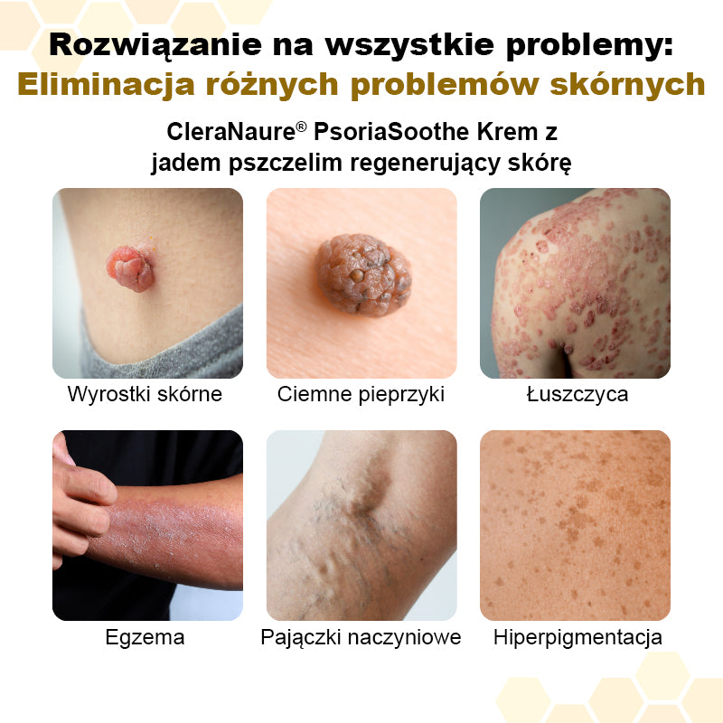 CleraNaure® PsoriaSoothe – Krem z jadem pszczelim przywracający zdrowie skórze