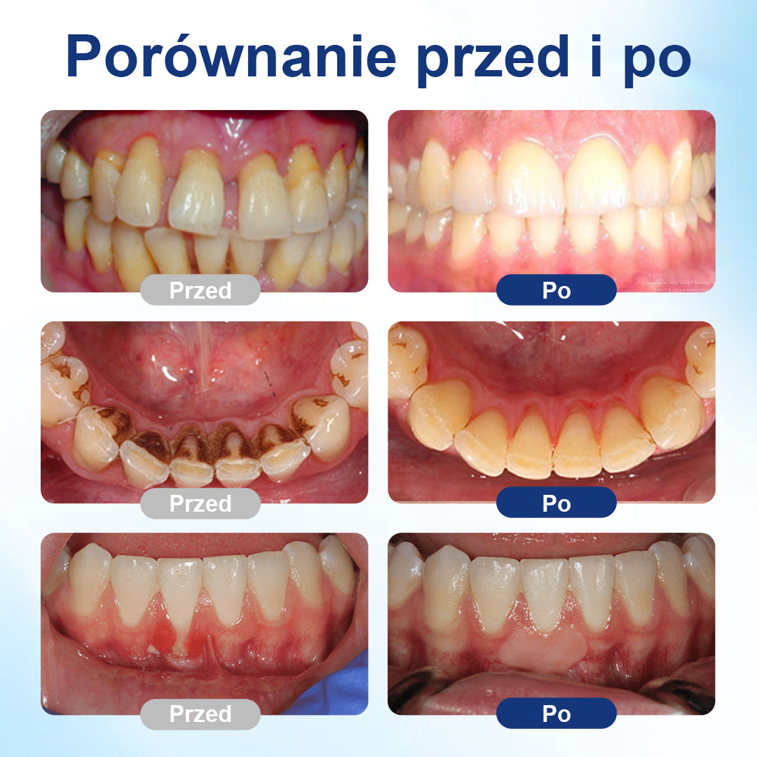 COLTURE® GumHoney Kropelki do Regeneracji Dziąseł