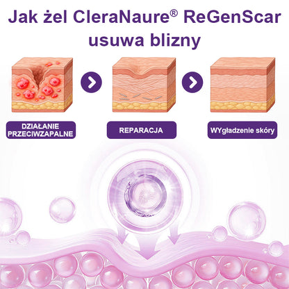 🥇CleraNaure® ReGenScar Żel na Blizny z Komórkami Macierzystymi