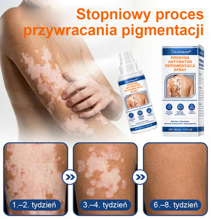 Spray aktywujący repigmentację Piperine Repigment Aktivator® CleraNaure, który aktywuje uśpione komórki pigmentowe i przywraca naturalny kolor skóry.