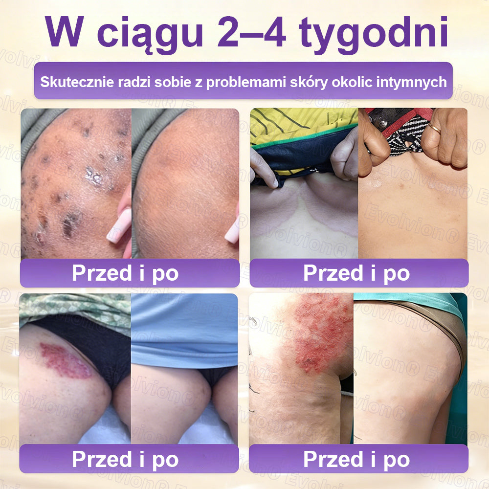 🥇CleraNaure® Krem do Skóry Biotyna 10-w-1 – Odbudowa i Regeneracja