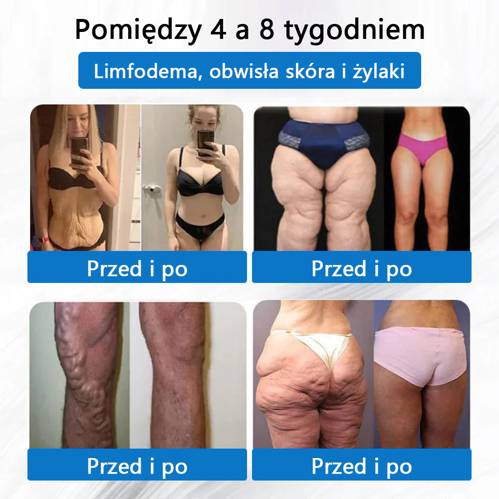 ⭐⭐CleraNaure® 7-w-1 metabolizm i ujędrniająca plastra (technologia mikrodyfuzji, 24-godzinny efekt) do kontroli wagi, apetytu, energii i metabolizmu cukru 💡