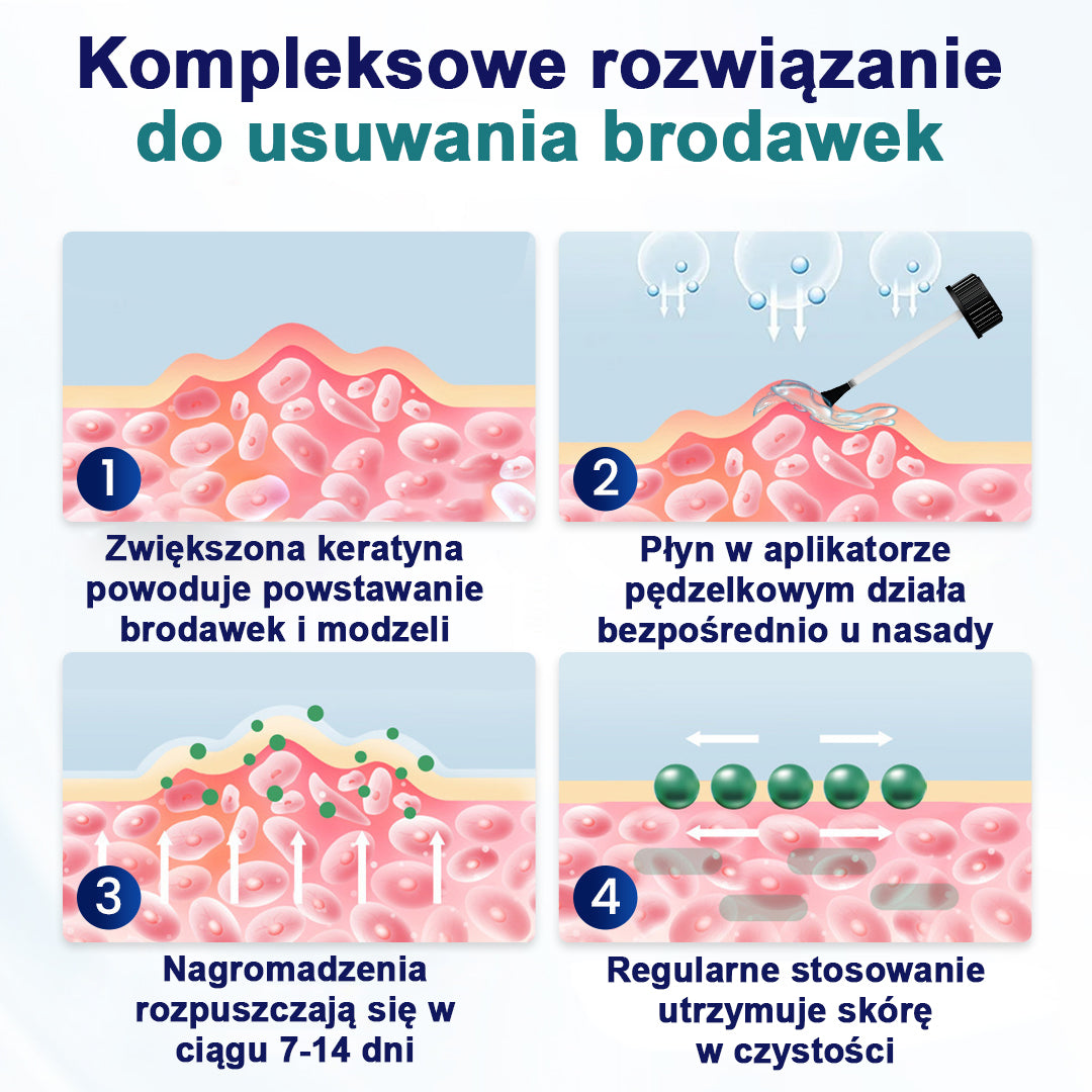 CleraNaure® WartLift Płyn do usuwania odcisków