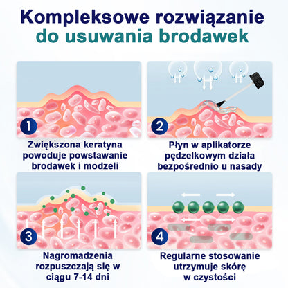 CleraNaure® WartLift Płyn do usuwania odcisków