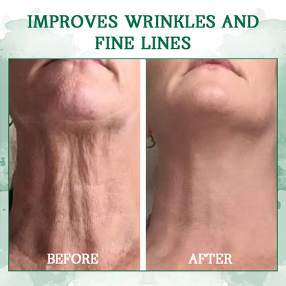 | Last Day Promotion 𝟕𝟎%𝐎𝐅𝐅🌿💝| - 💧Fubsta® SkinFirming Rejuvenating Serum🔥