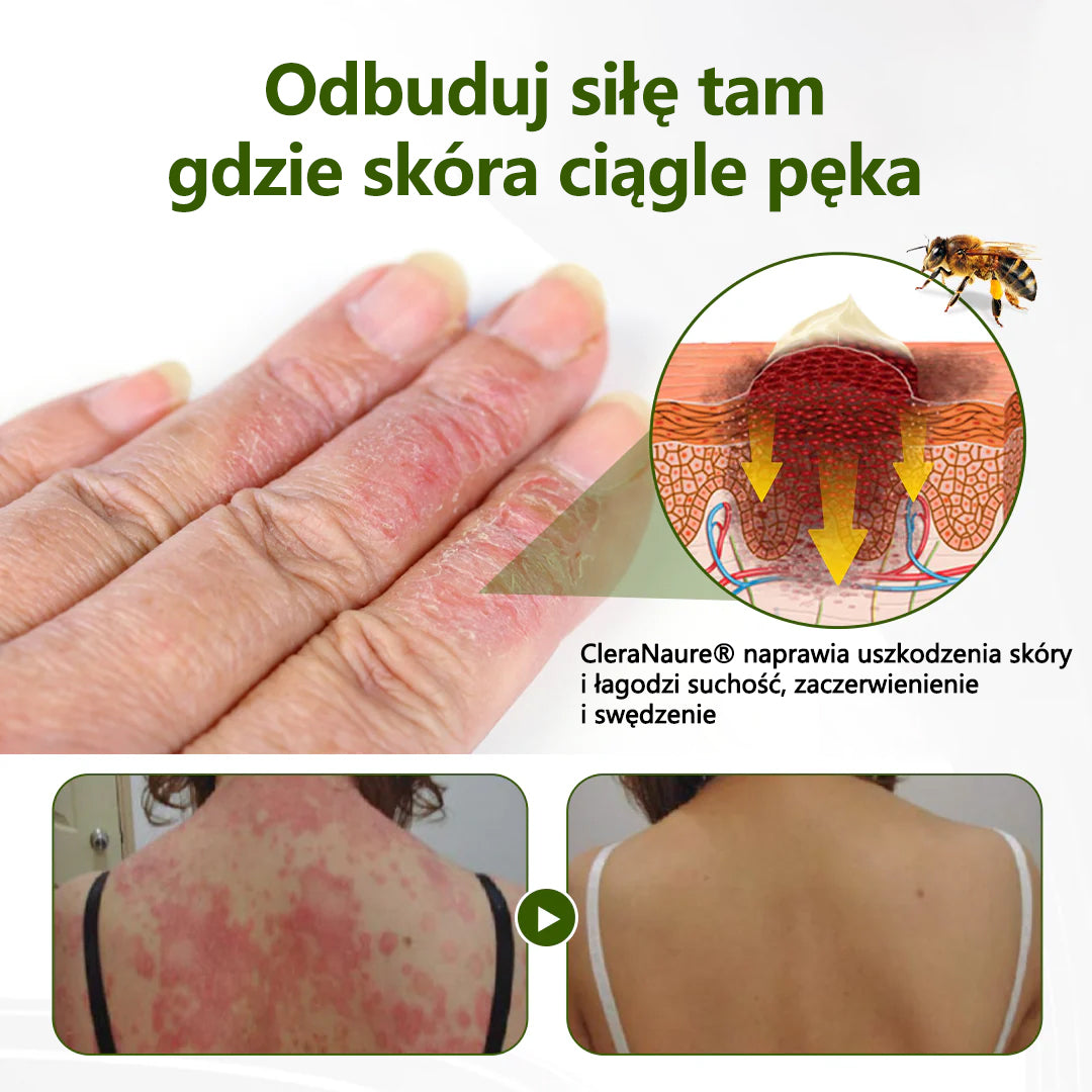 CleraNaure® BeePeptide RootSoft DualRelief Krem