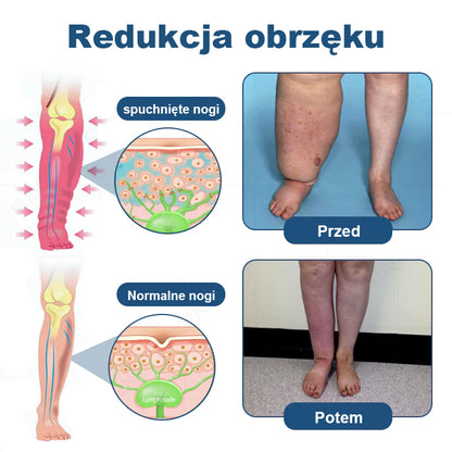 CleraNaure® Krem w Roll-Onie do Drenażu Limfatycznego i Redukcji Obrzęków