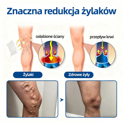🥇Healrize® VeinTarget Plaster z mikroigłami✨