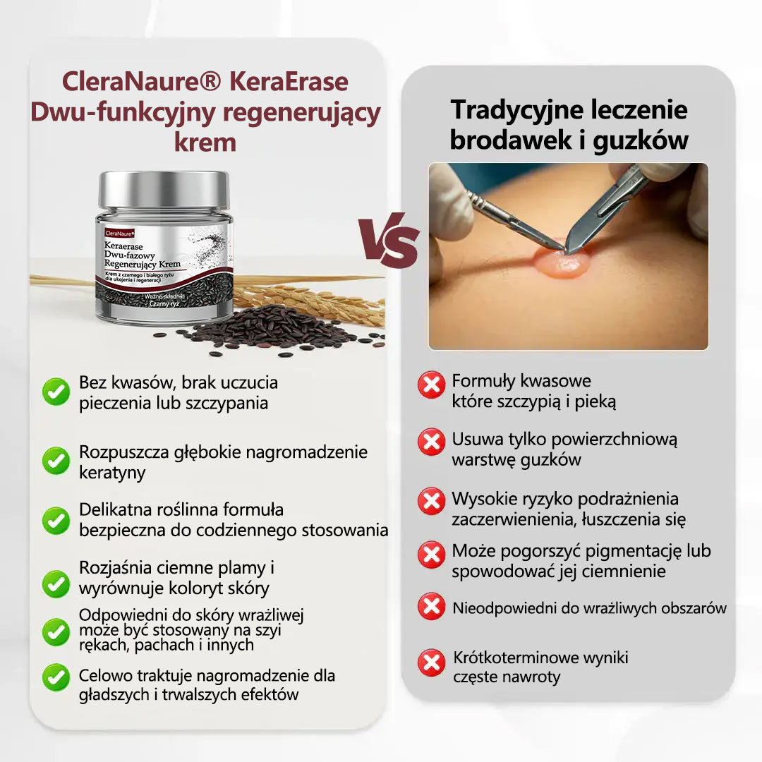 ⭐🏅 Oficjalny sklep CleraNaure® Keraerase Krem Odnowy o Podwójnym Działaniu - Krem z podwójnym działaniem do regeneracji skóry (wygładza wypukłe grudki i rozkłada głębokie nagromadzenie keratyny bez kwasów i podrażnień)