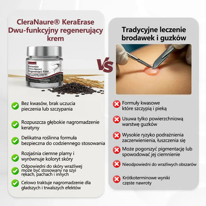 ⭐🏅 Oficjalny sklep CleraNaure® Keraerase Krem Odnowy o Podwójnym Działaniu - Krem z podwójnym działaniem do regeneracji skóry (wygładza wypukłe grudki i rozkłada głębokie nagromadzenie keratyny bez kwasów i podrażnień)