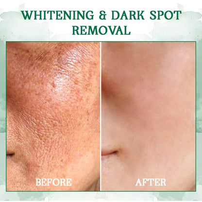 | Last Day Promotion 𝟕𝟎%𝐎𝐅𝐅🌿💝| - 💧Fubsta® SkinFirming Rejuvenating Serum🔥