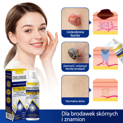 CleraNaure® ChillErase spray do usuwania nierówności