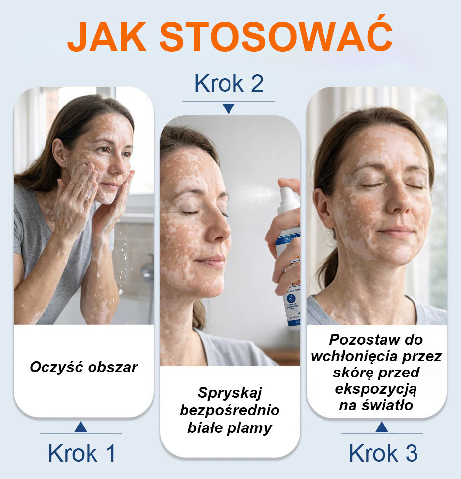 Spray aktywujący repigmentację Piperine Repigment Aktivator® CleraNaure, który aktywuje uśpione komórki pigmentowe i przywraca naturalny kolor skóry.