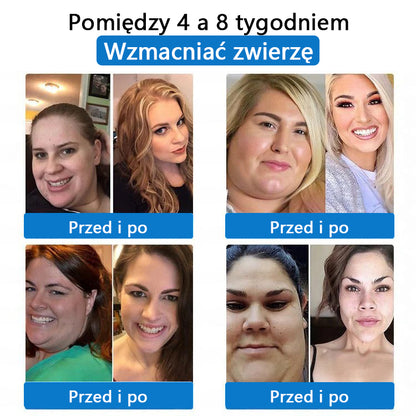 ⭐⭐CleraNaure® 7-w-1 metabolizm i ujędrniająca plastra (technologia mikrodyfuzji, 24-godzinny efekt) do kontroli wagi, apetytu, energii i metabolizmu cukru 💡