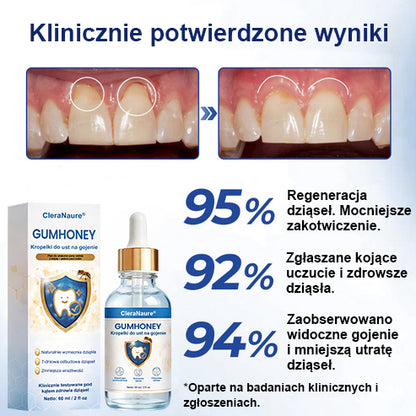 COLTURE® GumHoney Kropelki do Regeneracji Dziąseł