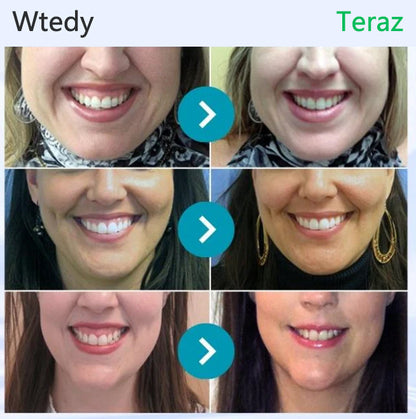 CleraNaure® VioCore Pszczeli Jad Kuracja Dentystyczna Pasta do Zębów
