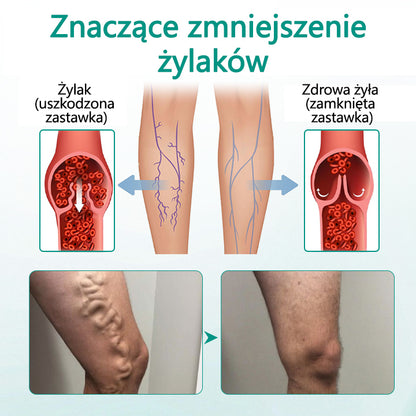 CleraNaure® LegRenew Plaster na żylaki