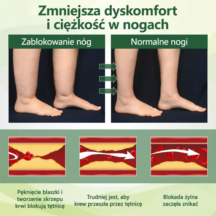 Pożegnaj się z opuchniętymi, bolącymi nogami – CleraNaure® FluidEase Profesjonalny krem na krążenie w nogach przynosi prawdziwą ulgę! ✨🦵