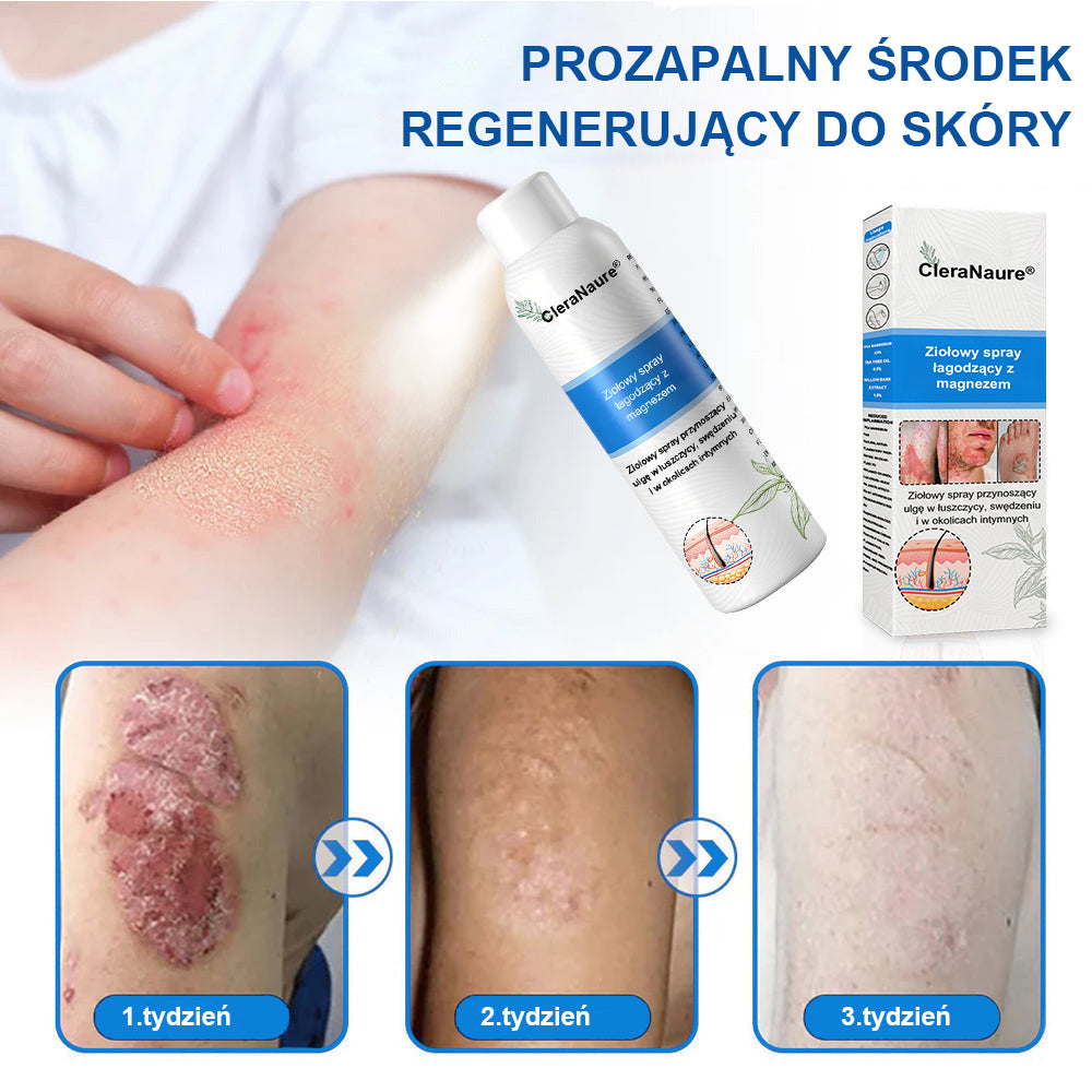 CleraNature® Magnesium Spray – Szybka Ulga dla Swędzącej, Czerwonej i Wrażliwej Skóry (Nawet w Strefach Intymnych)