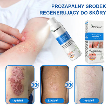 CleraNature® Magnesium Spray – Szybka Ulga dla Swędzącej, Czerwonej i Wrażliwej Skóry (Nawet w Strefach Intymnych)