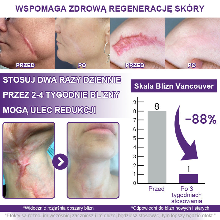 🥇CleraNaure® ReGenScar Żel na Blizny z Komórkami Macierzystymi
